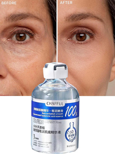 Hyaluronic Acid Facial Essence - Deep Moisturizing Skin Care Duo for Dry Skin Relief