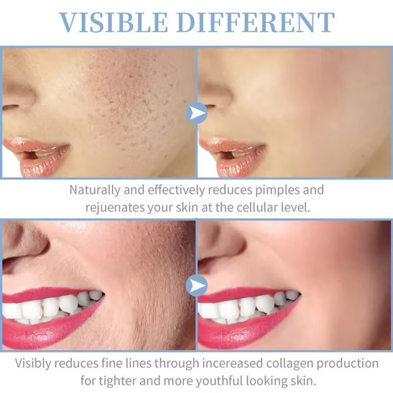 4-in-1 Portable High Frequency Facial Therapy Wand for Acne Treatment and Skin Beauty Care